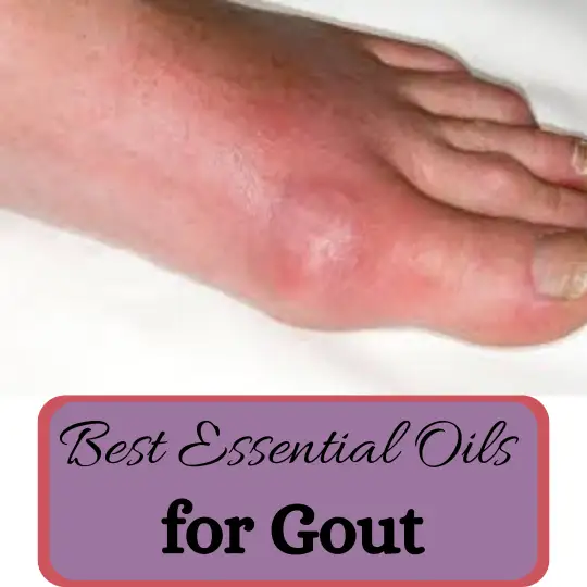 15 Best Essential Oils For Gout: A Natural Approach To Managing Pain